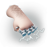 Électropoings